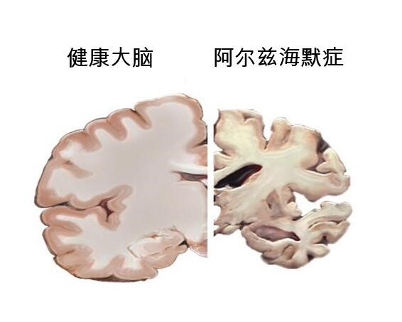 1507811889665753.jpg 80.jpg
